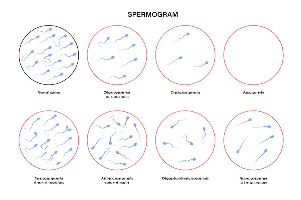 Normal Sperm Color Chart: Gray, Green, Brown, Texture Changes